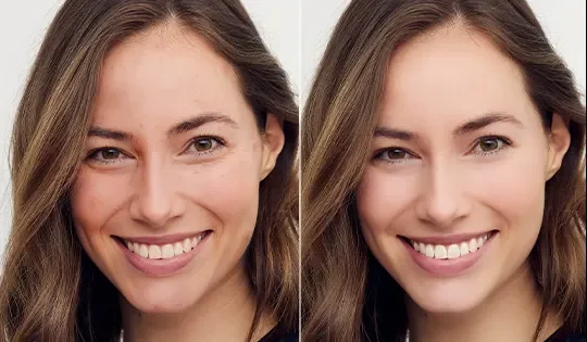 Automatische Hautglättung für das Gesicht