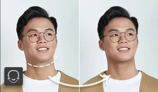 Gesichtsretusche: Kieferlinie